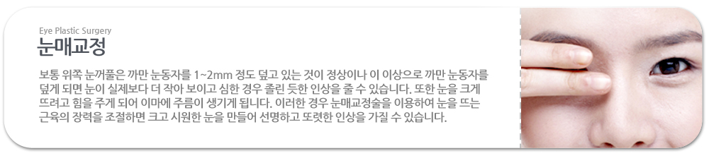 눈매교정:보통 위쪽 눈꺼풀은 까만 눈동자를 1~2mm 정도 덮고 있는 것이 정상이나 이 이상으로 까만 눈동자를 덮게 되면 눈이 실제보다 더 작아 보이고 심한 경우 졸린 듯한 인상을 줄 수 있습니다. 또한 눈을 크게 뜨려고 힘을 주게 되어 이마에 주름이 생기게 됩니다. 이러한 경우 눈매교정술을 이용하여 눈을 뜨는 근육의 장력을 조절하면 크고 시원한 눈을 만들어 선명하고 또렷한 인상을 가질 수 있습니다. 