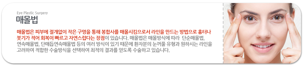 매몰법:매몰법은 피부에 절개없이 작은 구멍을 통해 봉합사를 매몰시킴으로서 라인을 만드는 방법으로 흉터나 붓기가 적어 회복이 빠르고 자연스럽다는 장점이 있습니다. 매몰법은 매몰방식에 따라  단순매몰법, 연속매몰법, 단매듭연속매몰법 등의 여러 방식이 있기 때문에 환자분의 눈꺼풀 유형과 원하시는 라인을 고려하여 적합한 수술방식을 선택하여 최적의 결과를 얻도록 수술하고 있습니다. 