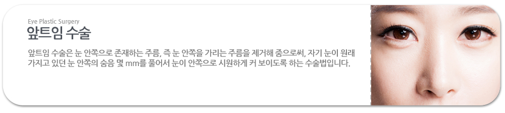 앞트임 수술:앞트임 수술은 눈 안쪽으로 존재하는 주름, 즉 눈 안쪽을 가리는 주름을 제거해 줌으로써, 자기 눈이 원래 가지고 있던 눈 안쪽의 숨음 몇 mm를 풀어서 눈이 안쪽으로 시원하게 커 보이도록 하는 수술법입니다.