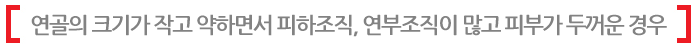 연골의 크기가 작고 약하면서 피하조직, 연부조직이 많고 피부가 두꺼운 경우