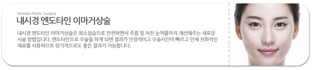 내시경 엔도타인 이마거상술은 최소침습으로 안전하면서 주름 및 처진 눈꺼풀까지 개선해주는 새로운 시술 방법입니다. 엔도타인으로 수술을 하게 되면 결과가 안정적이고 수술시간이 빠르고 인체 친화적인 재료를 사용하므로 장기적으로도 좋은 결과가 가능합니다. 