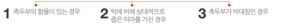 측두부의 함몰이 있는 경우/ 턱에 비해 상대적으로 좁은 이마를 가진 경우/ 측두부가 비대칭인 경우