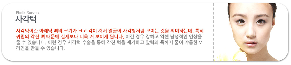 사각턱
사각턱이란 아래턱 뼈의 크기가 크고 각이 져서 얼굴이 사각형처럼 보이는 것을 의미하는데, 특히 귀밑의 각진 뼈 때문에 실제보다 더욱 커 보이게 됩니다. 이런 경우 강하고 억센 남성적인 인상을 줄 수 있습니다. 이런 경우 사각턱 수술을 통해 각진 턱을 제거하고 앞턱의 폭까지 줄여 갸름한 V라인을 만들 수 있습니다. 
