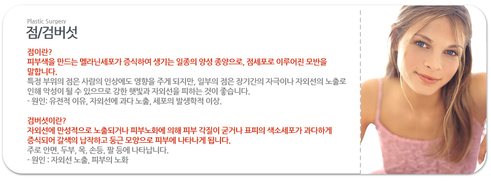 점이란?
 피부색을 만드는 멜라닌세포가 증식하여 생기는 일종의 양성 종양으로, 점세포로 이루어진 모반을 말합니다.
 특정 부위의 점은 사람의 인상에도 영향을 주게 되지만, 일부의 점은 장기간의 자극이나 자외선의 노출로 인해 악성이 될 수 있으므로 강한 햇빛과 자외선을 피하는 것이 좋습니다.