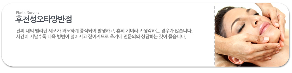 *후천성오타양반점
진피 내의 멜라닌 세포가 과도하게 증식되어 발생하고, 흔히 기미라고 생각하는 경우가 많습니다.  시간이 지날수록 더욱 병변이 넓어지고 짙어지므로 초기에 전문의와 상담하는 것이 좋습니다..