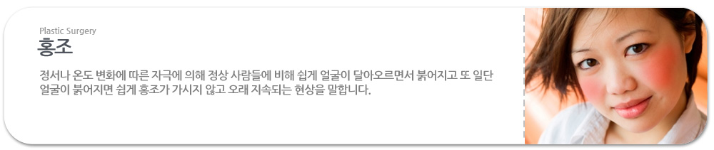 *홍조란?
 정서나 온도 변화에 따른 자극에 의해 정상 사람들에 비해 쉽게 얼굴이 달아오르면서 붉어지고 또 일단 얼굴이 붉어지면 쉽게 홍조가 가시지 않고 오래 지속되는 현상을 말합니다.